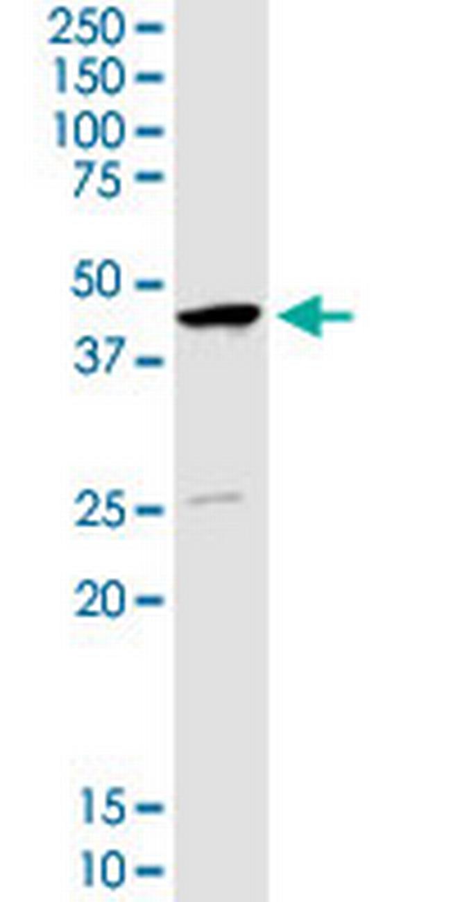 SERPINB1 Antibody in Western Blot (WB)