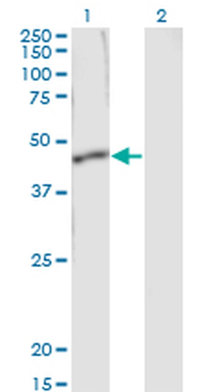 SERPINB1 Antibody in Western Blot (WB)