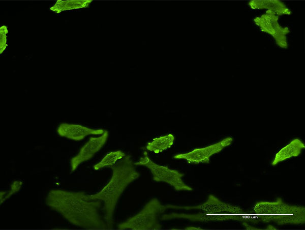 SERPINB1 Antibody in Immunocytochemistry (ICC/IF)