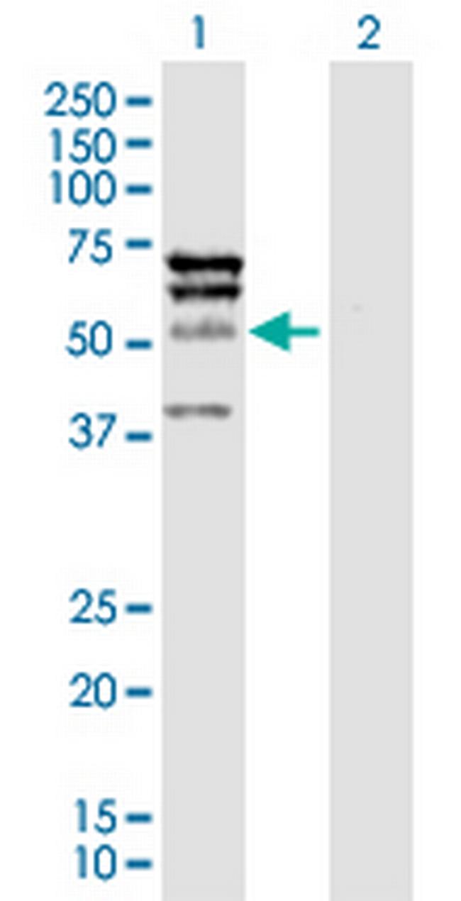 ELK4 Antibody in Western Blot (WB)