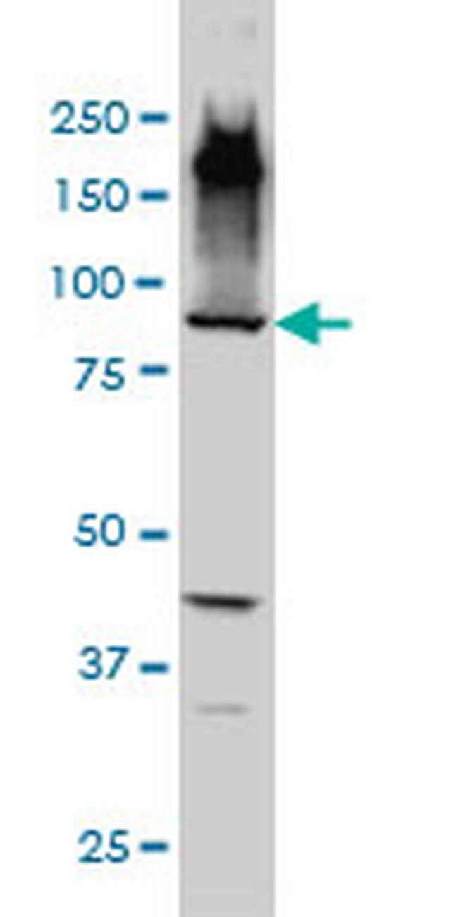 EML1 Antibody in Western Blot (WB)
