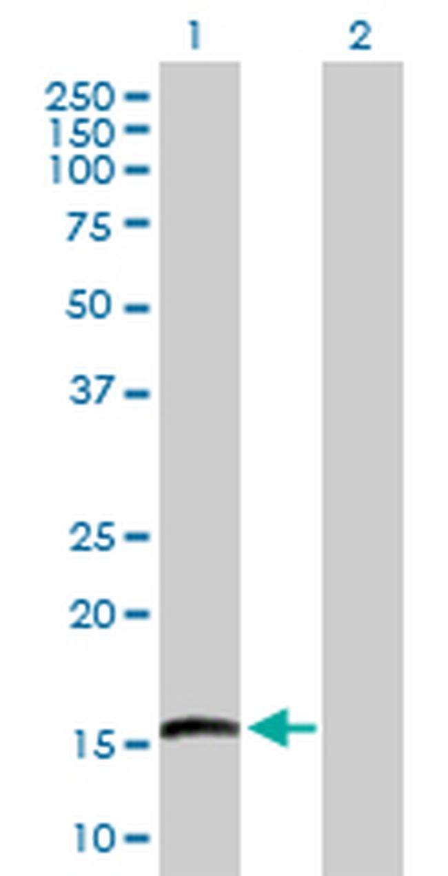 EMP3 Antibody in Western Blot (WB)