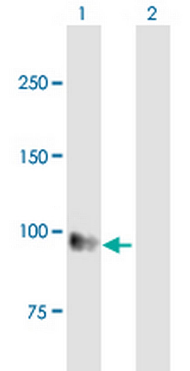 EMR1 Antibody in Western Blot (WB)