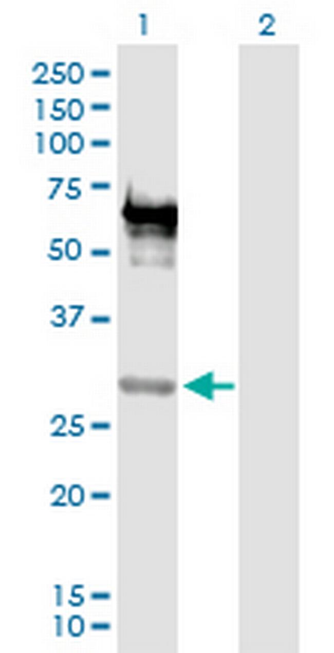 EMX2 Antibody in Western Blot (WB)