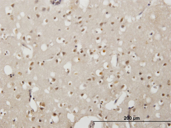 EMX2 Antibody in Immunohistochemistry (Paraffin) (IHC (P))