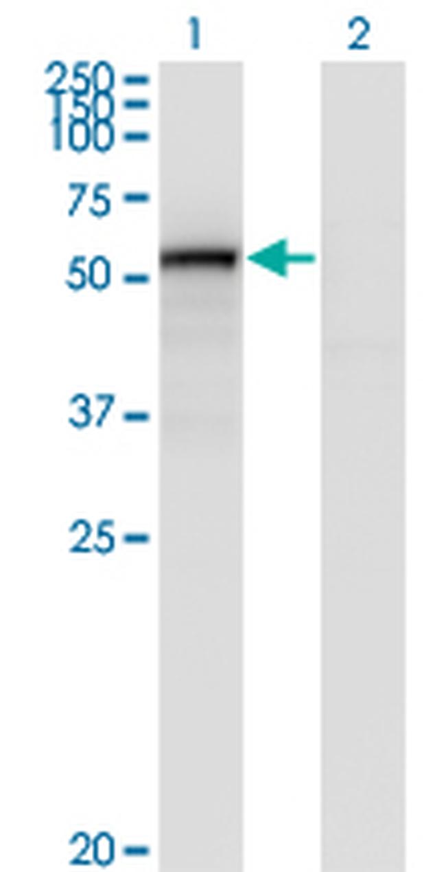 ENG Antibody in Western Blot (WB)