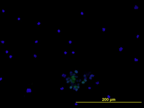 ENG Antibody in Immunocytochemistry (ICC/IF)