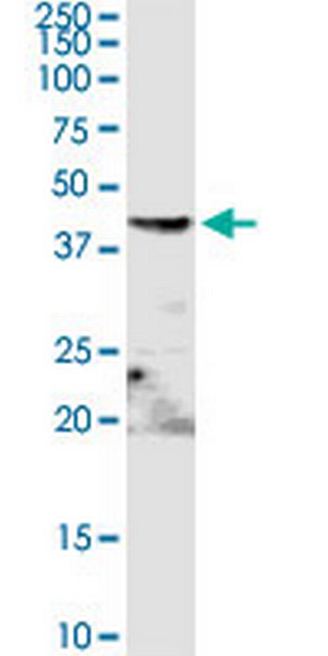 ENO3 Antibody in Western Blot (WB)