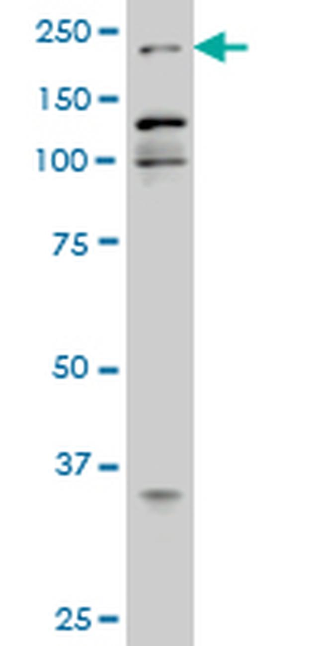 1d2 EP300 Monoclonal Antibody (1D2) | Invitrogen (H00002033-M02)