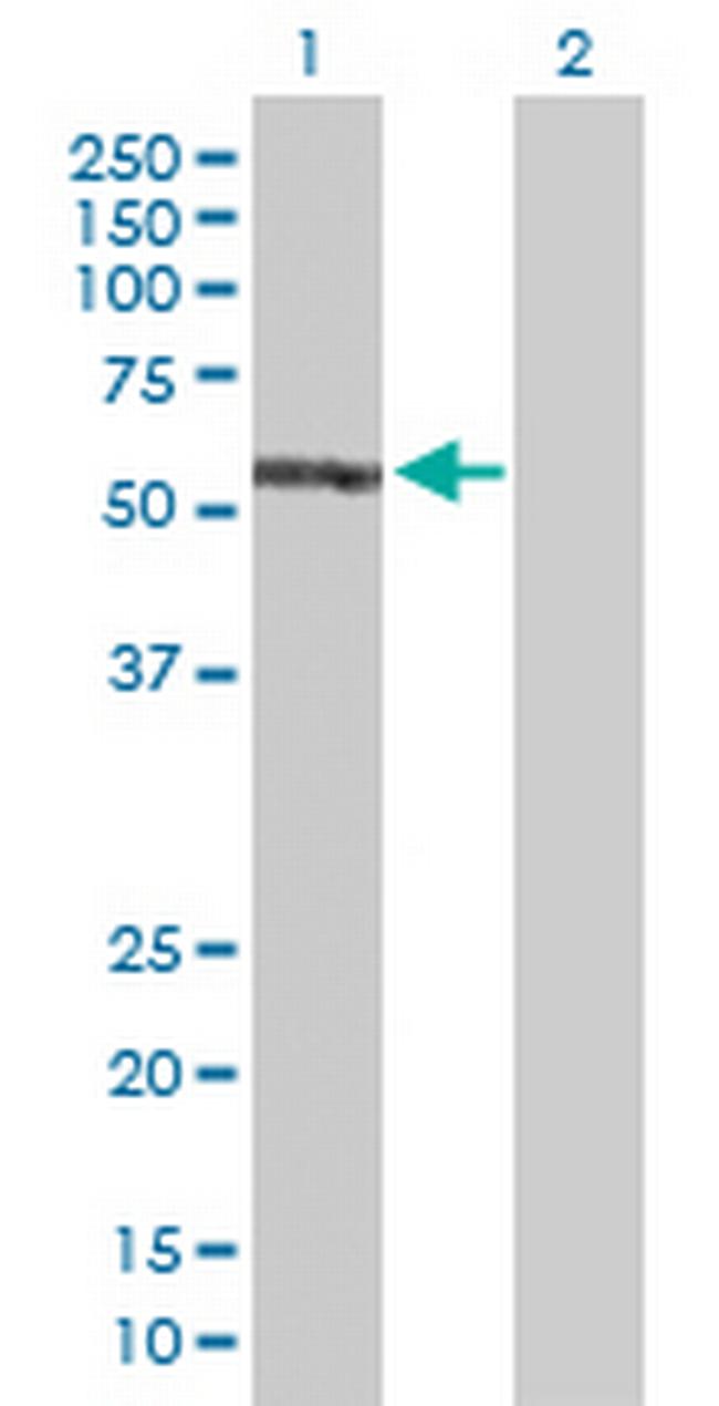 EPB41 Antibody in Western Blot (WB)