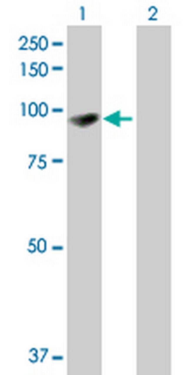 EPB41L1 Antibody in Western Blot (WB)