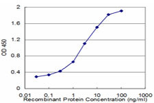 EPB41L1 Antibody in ELISA (ELISA)