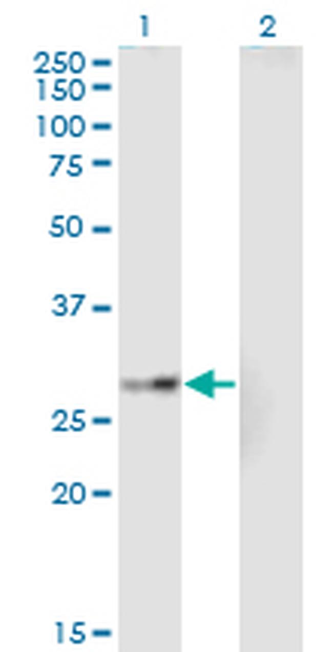 EPHA7 Antibody in Western Blot (WB)