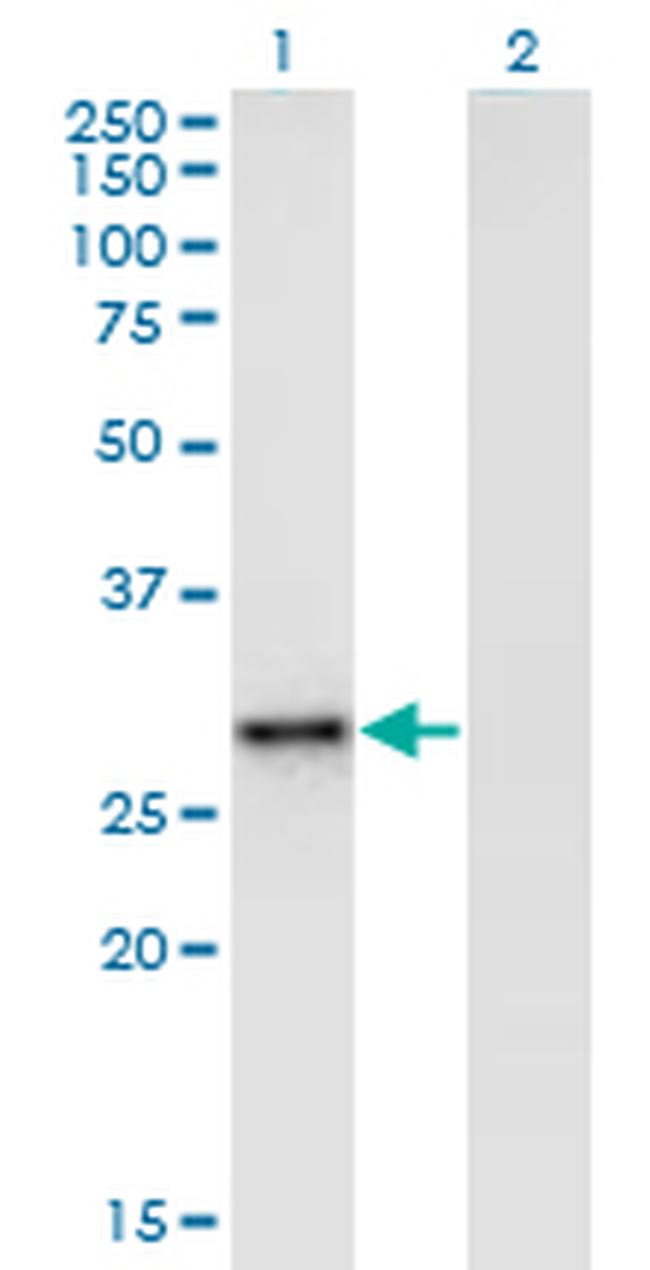 EPHA7 Antibody in Western Blot (WB)