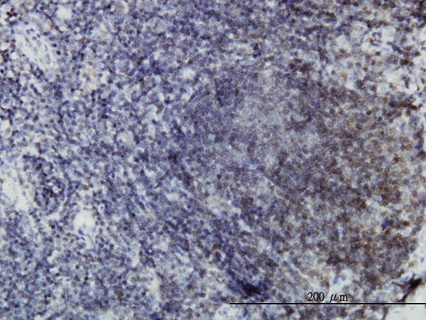 EPHB3 Antibody in Immunohistochemistry (Paraffin) (IHC (P))