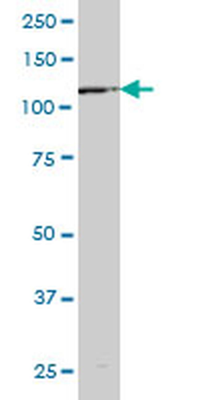 EPHB6 Antibody in Western Blot (WB)
