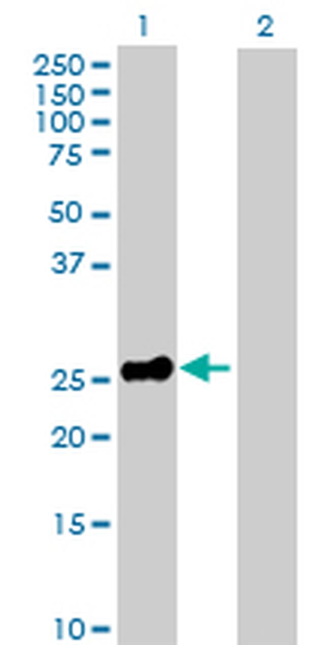 EPO Antibody in Western Blot (WB)