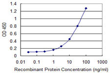 ERBB2 Antibody in ELISA (ELISA)