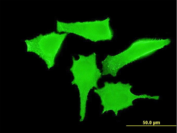 ERBB2 Antibody in Immunocytochemistry (ICC/IF)