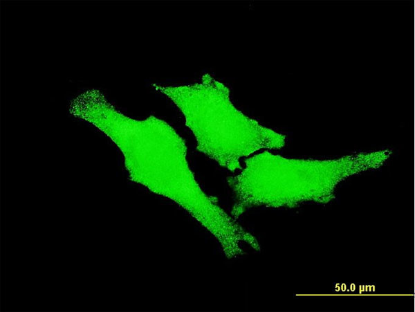 ERBB2 Antibody in Immunocytochemistry (ICC/IF)
