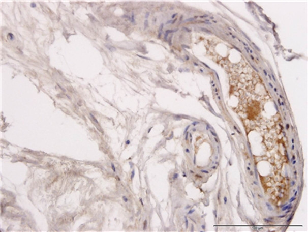 ERBB2 Antibody in Immunohistochemistry (Paraffin) (IHC (P))
