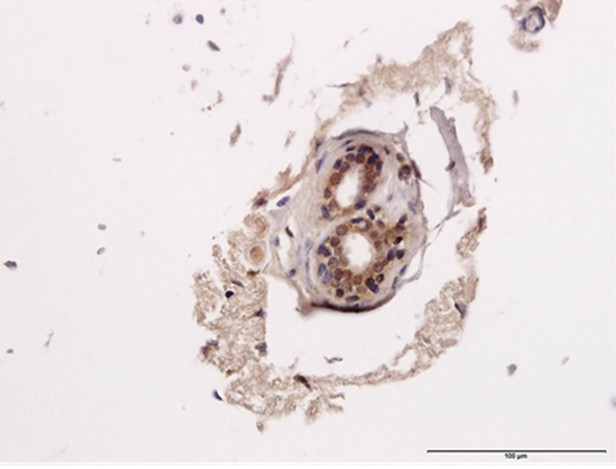 ERBB2 Antibody in Immunohistochemistry (Paraffin) (IHC (P))