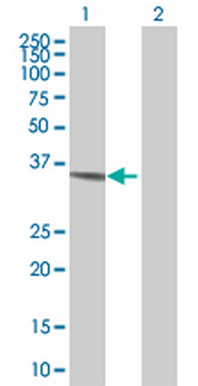 ERBB3 Antibody in Western Blot (WB)