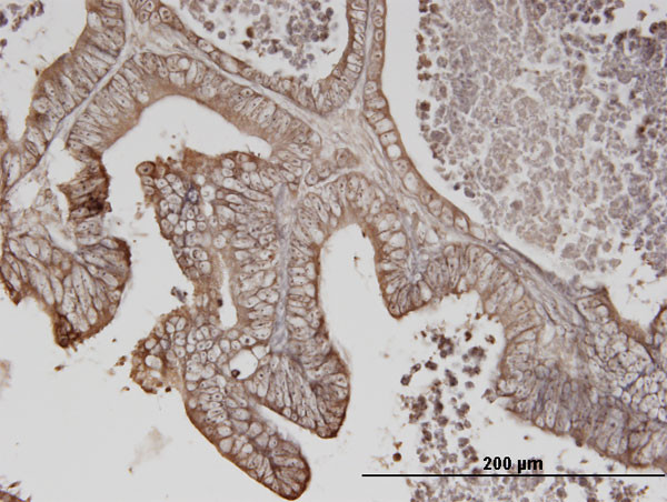 ERBB3 Antibody in Immunohistochemistry (Paraffin) (IHC (P))