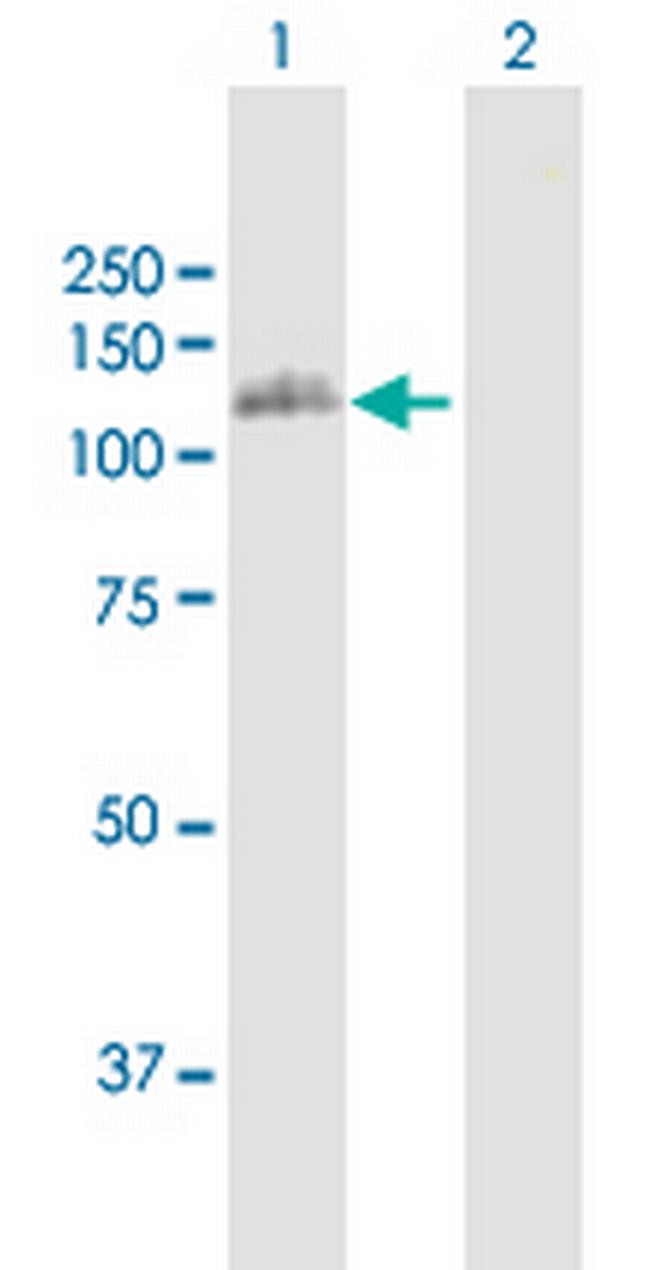 ERCC4 Antibody in Western Blot (WB)