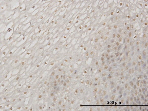 ERN1 Antibody in Immunohistochemistry (Paraffin) (IHC (P))