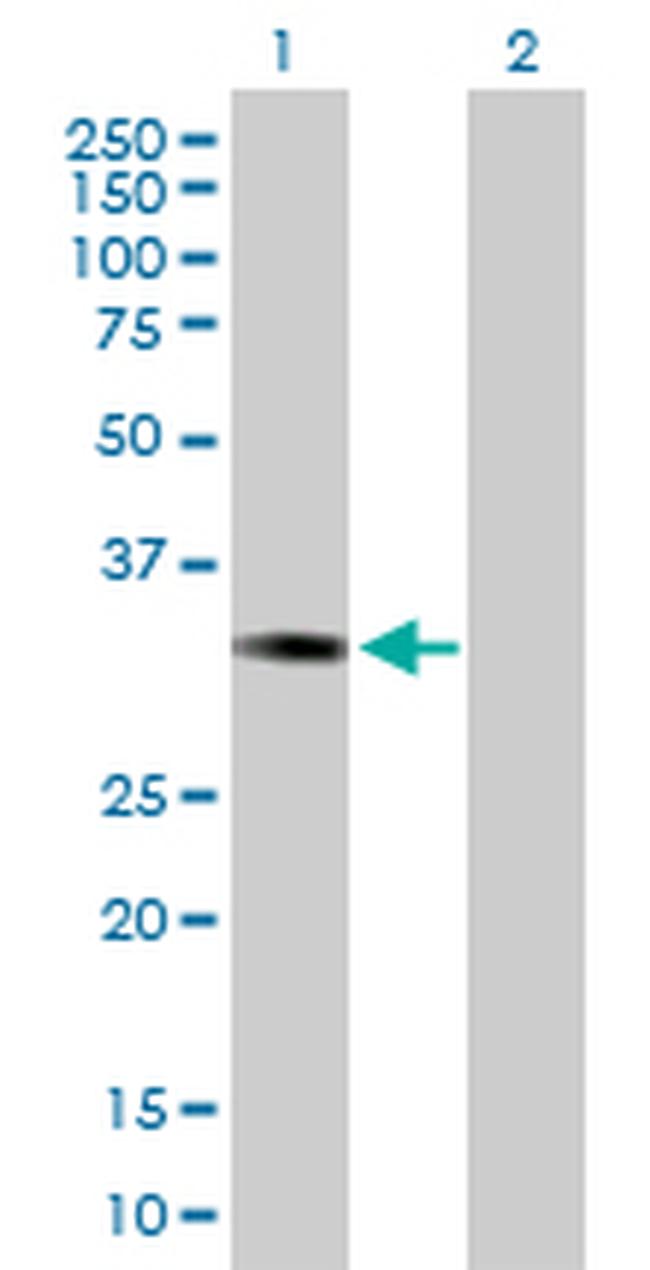 ESD Antibody in Western Blot (WB)