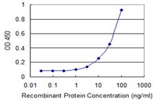 ESR1 Antibody in ELISA (ELISA)