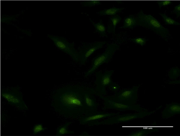 ESR1 Antibody in Immunocytochemistry (ICC/IF)