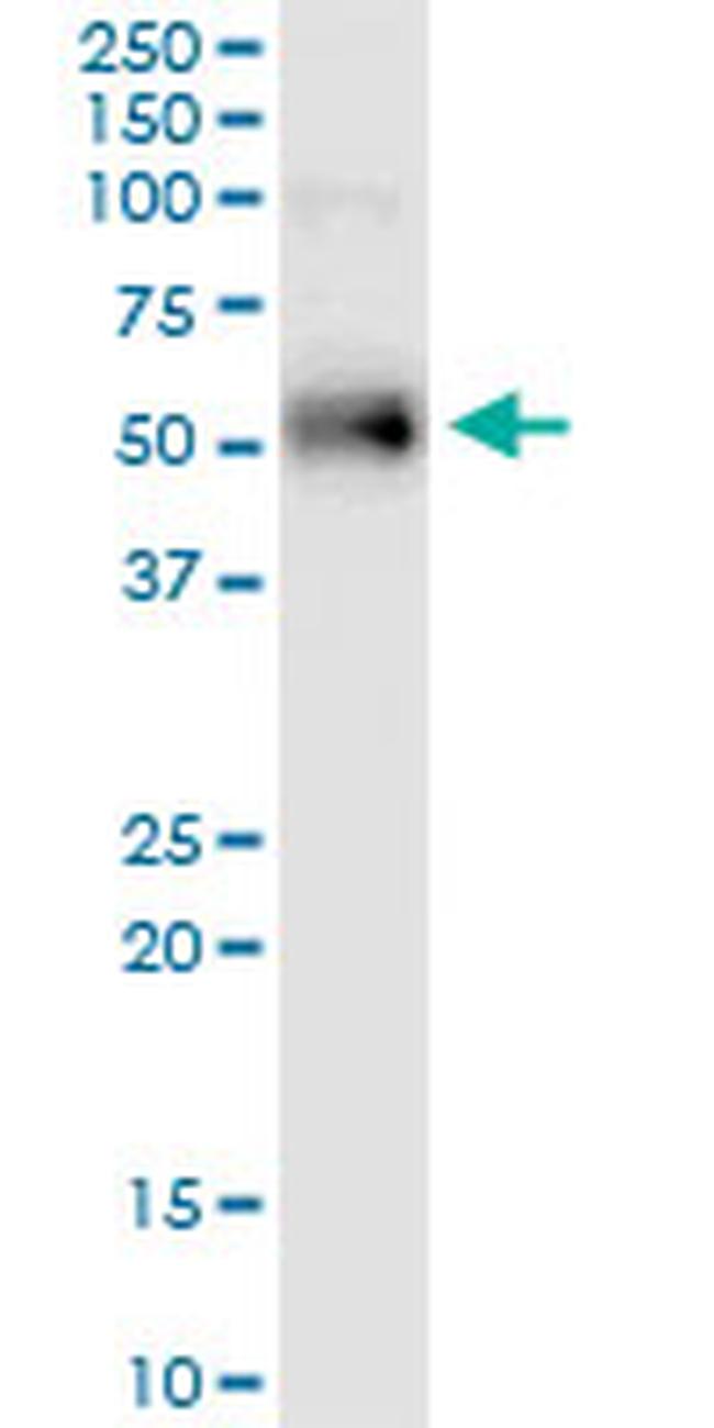 ETV1 Antibody in Western Blot (WB)