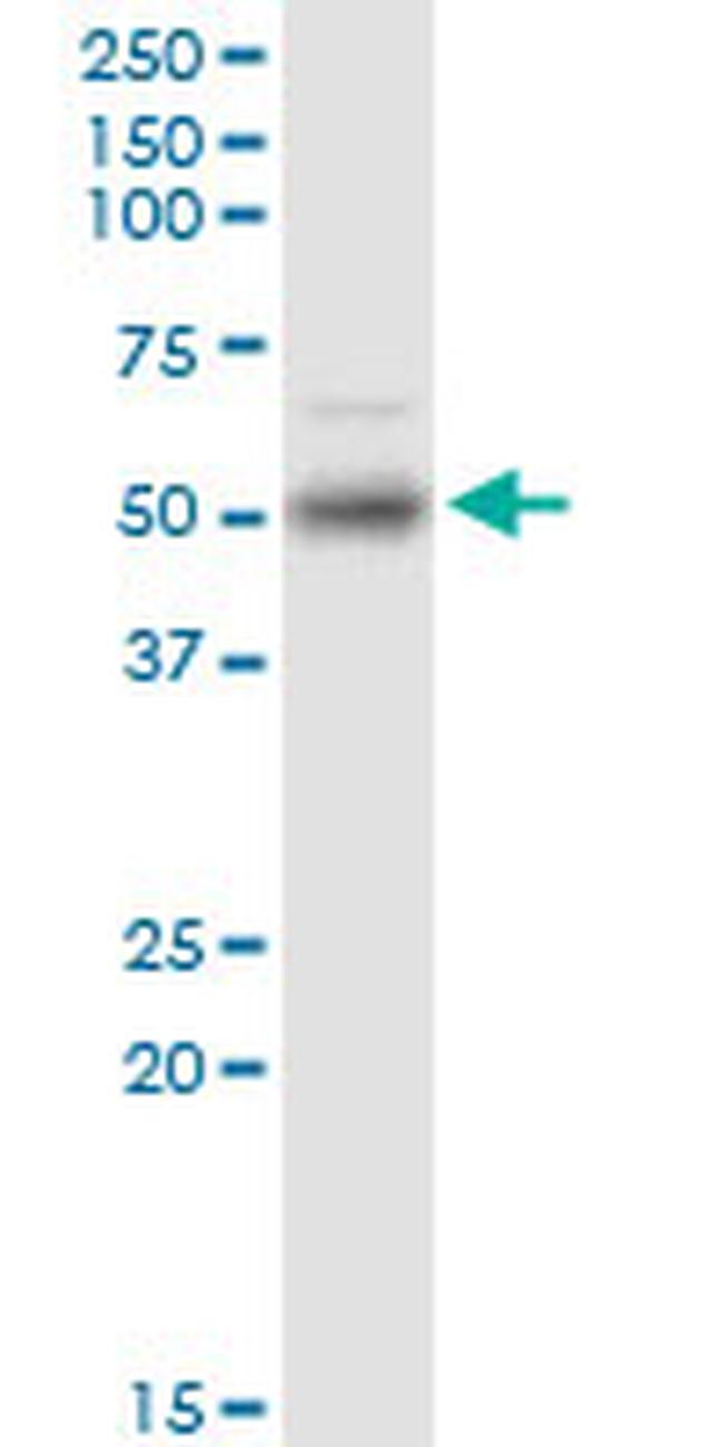 ETV1 Antibody in Western Blot (WB)