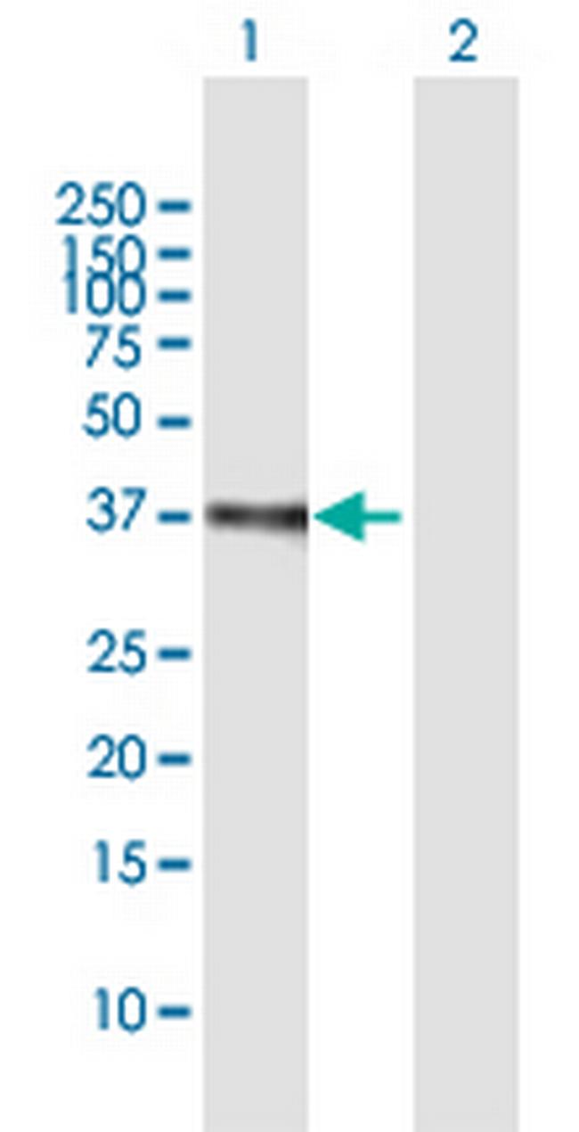ETV2 Antibody in Western Blot (WB)