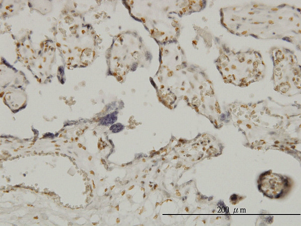 ETV6 Antibody in Immunohistochemistry (Paraffin) (IHC (P))