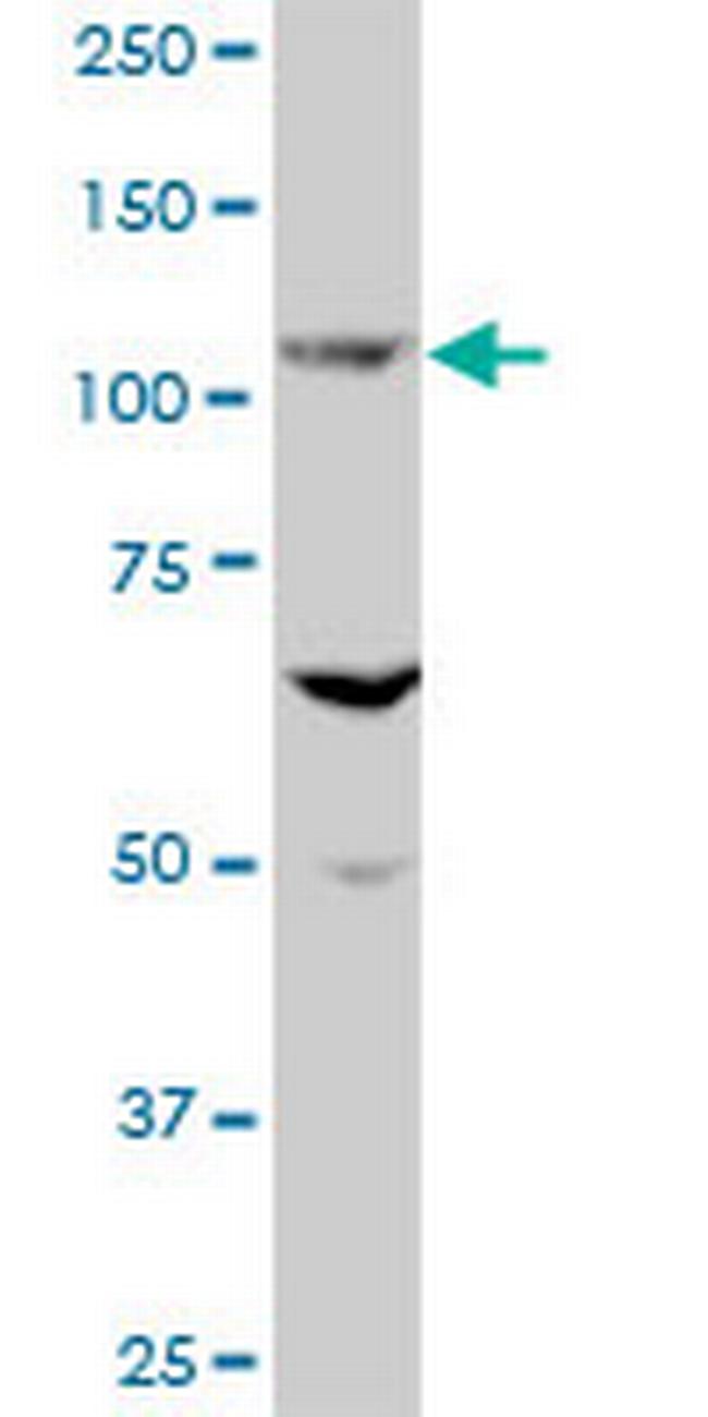 EVC Antibody in Western Blot (WB)