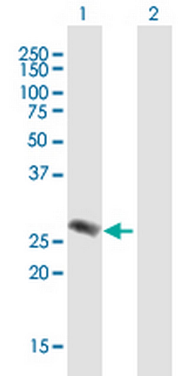 EVI2A Antibody in Western Blot (WB)