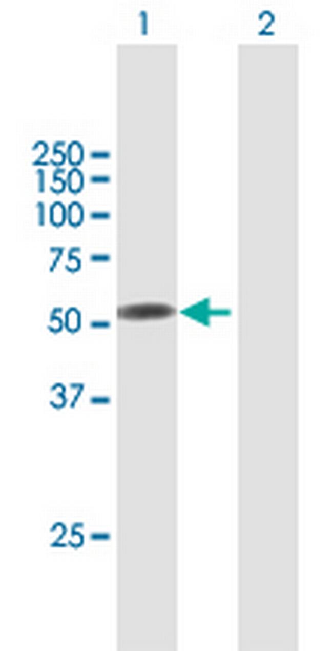 F9 Antibody in Western Blot (WB)