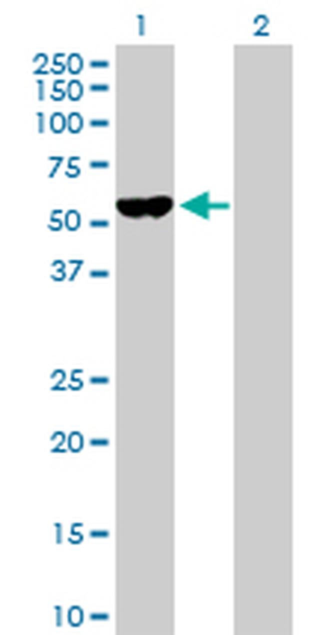 F9 Antibody in Western Blot (WB)