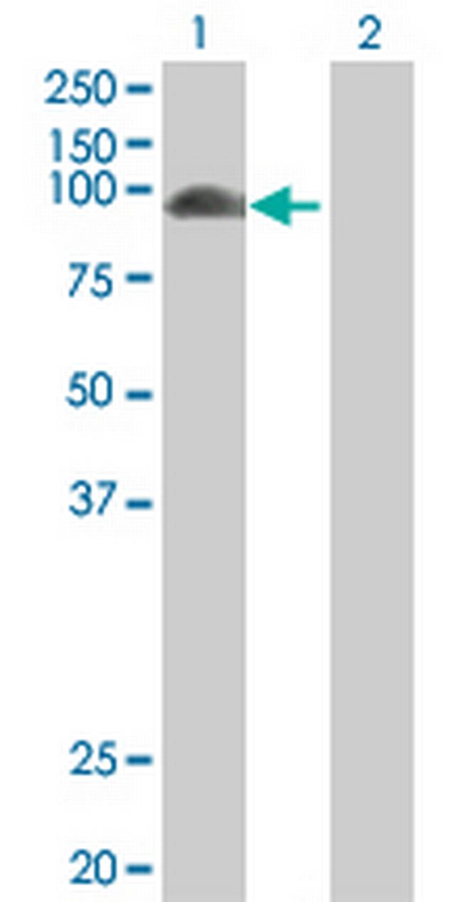 F13A1 Antibody in Western Blot (WB)