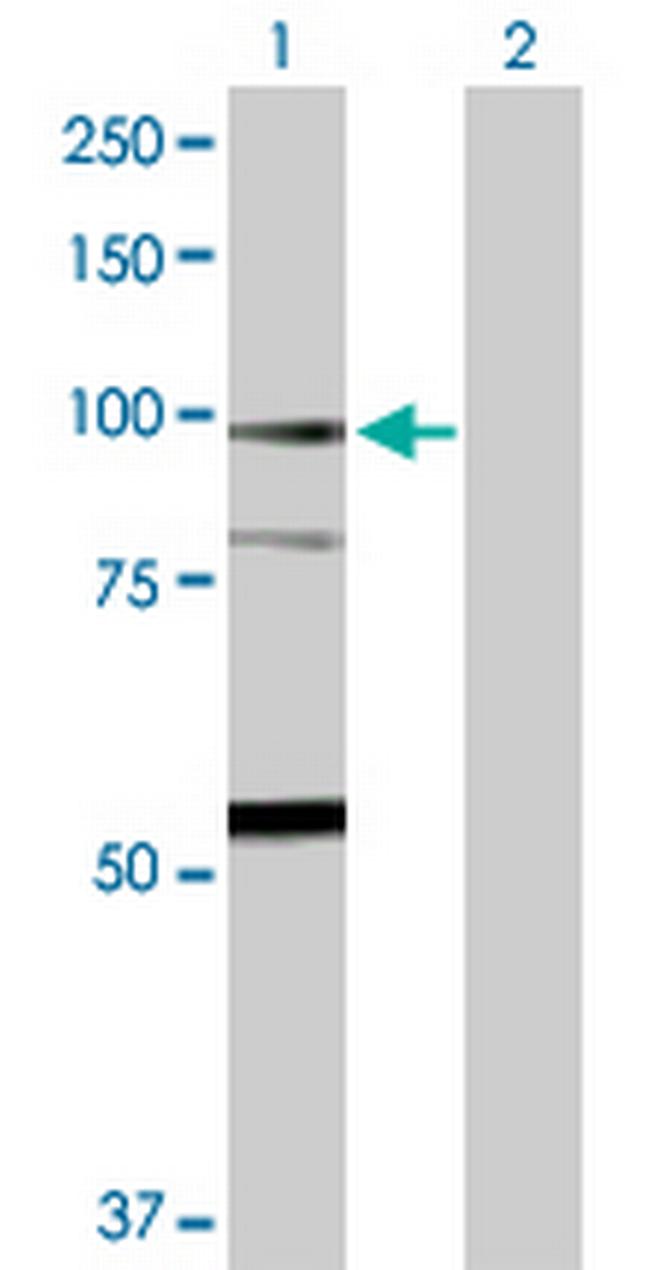 F13A1 Antibody in Western Blot (WB)