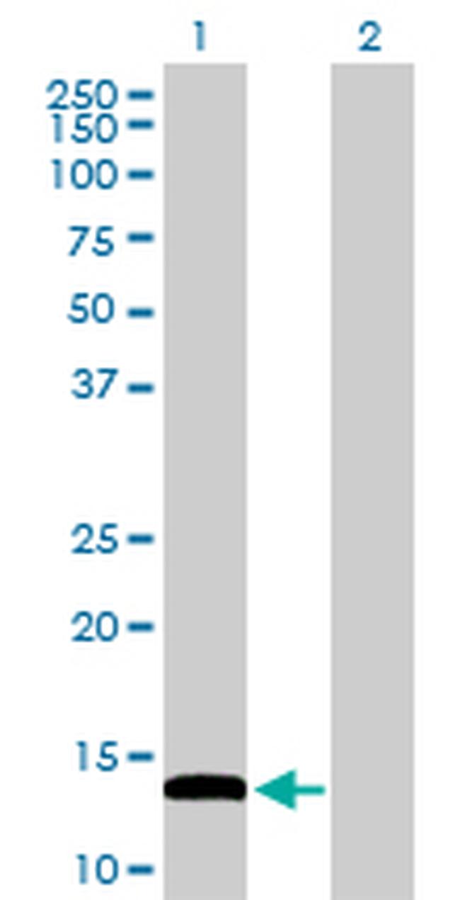 FABP4 Antibody in Western Blot (WB)