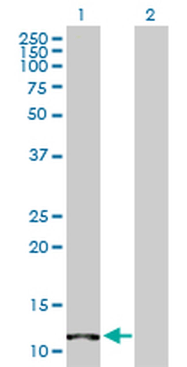 FABP4 Antibody in Western Blot (WB)