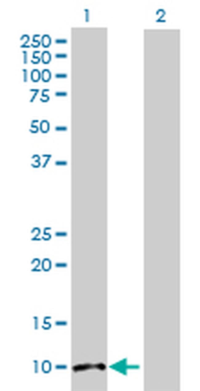 FABP1 Antibody in Western Blot (WB)