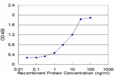 FABP1 Antibody in ELISA (ELISA)