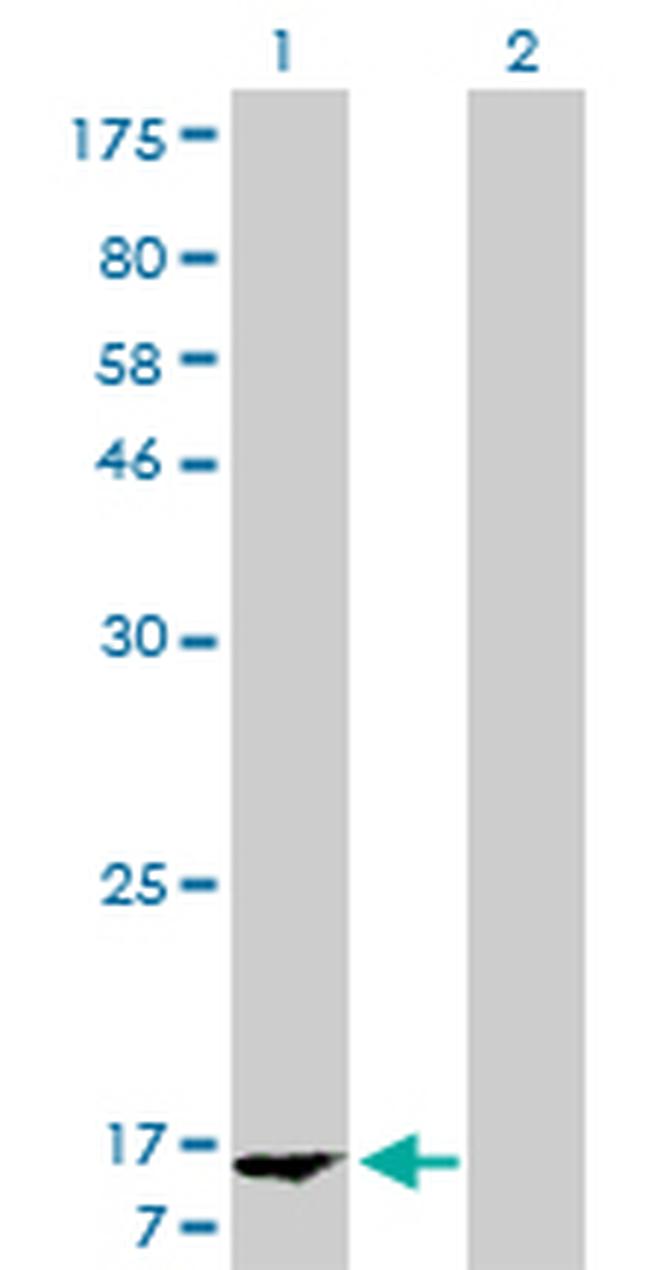 FABP1 Antibody in Western Blot (WB)