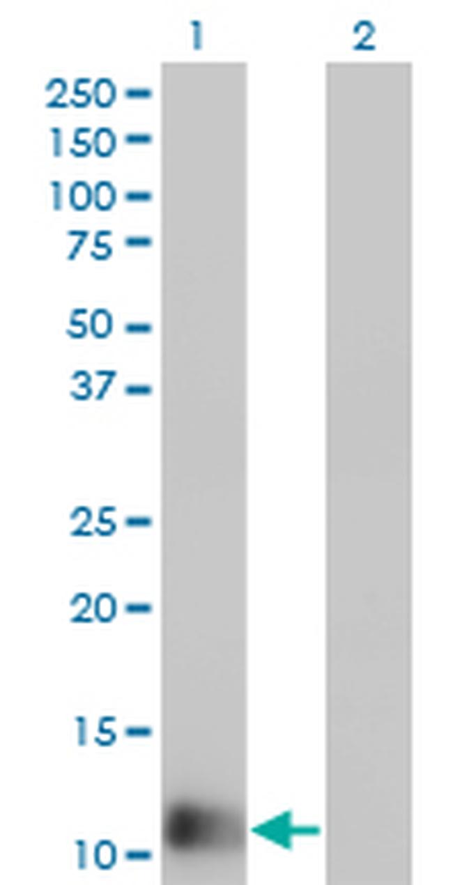 FABP1 Antibody in Western Blot (WB)