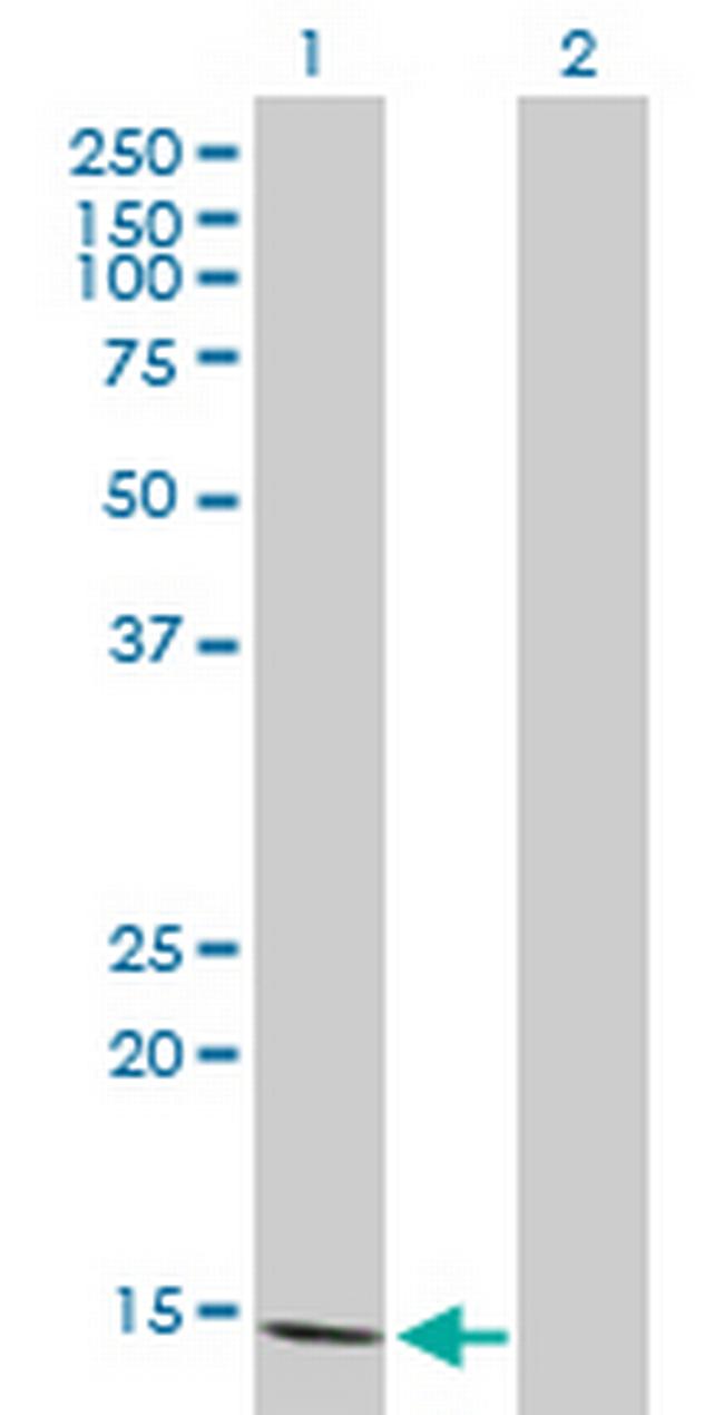 FABP5 Antibody in Western Blot (WB)